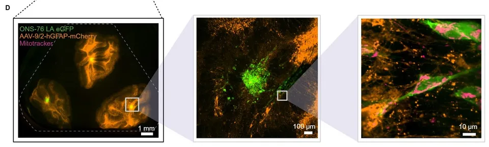 Graphical abstract: Platforms for live, high-resolution imaging of organotypic tissue slices