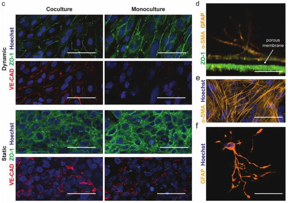 Graphical abstract: Blood-brain barrier and brain tumor models